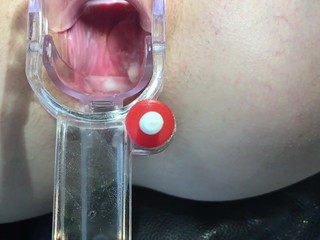 petite nymphet onlyfans a nice, close-up view of my cervix