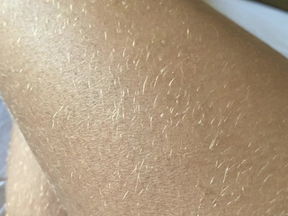 Alice Marques  09 September 2020